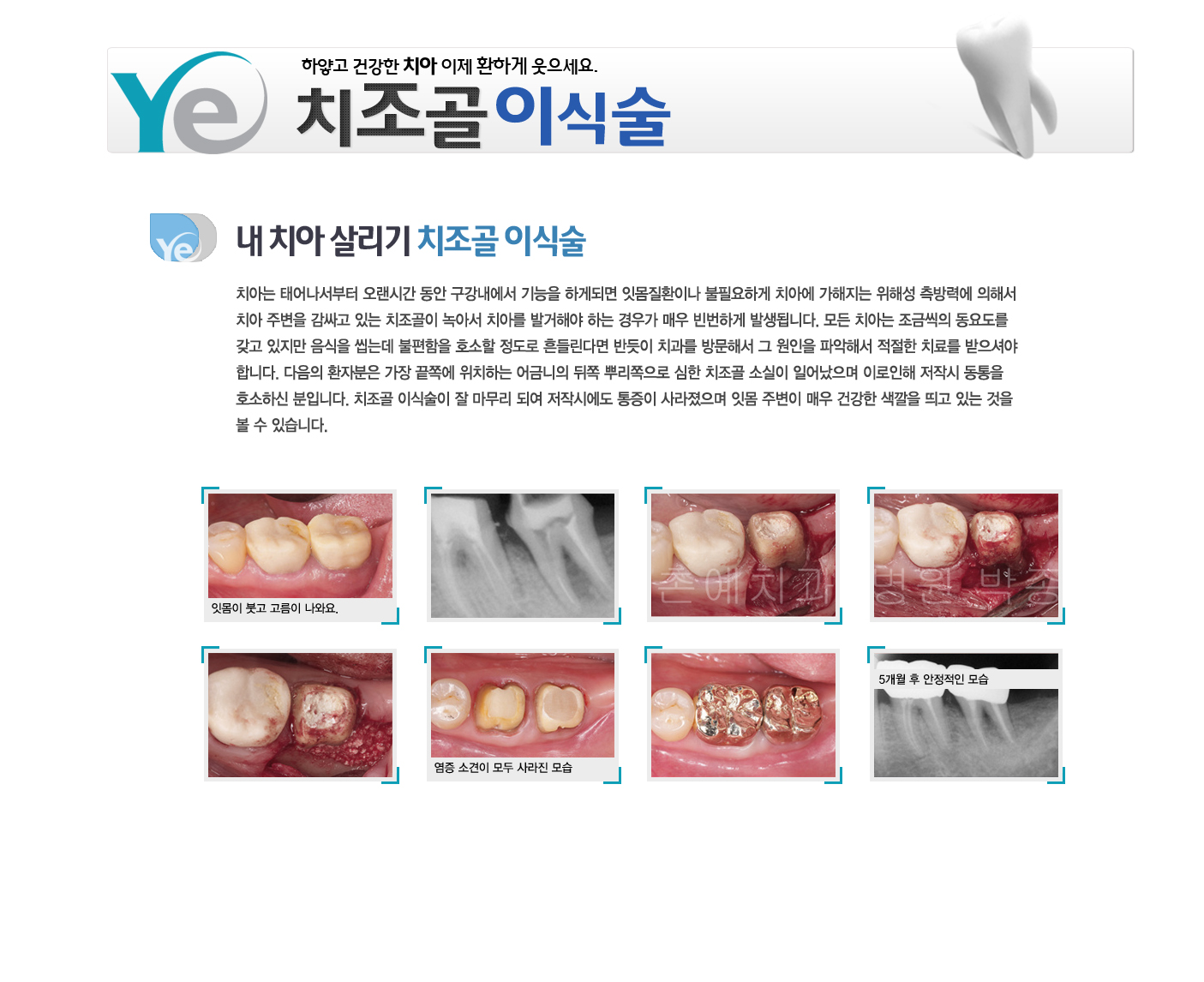 곻